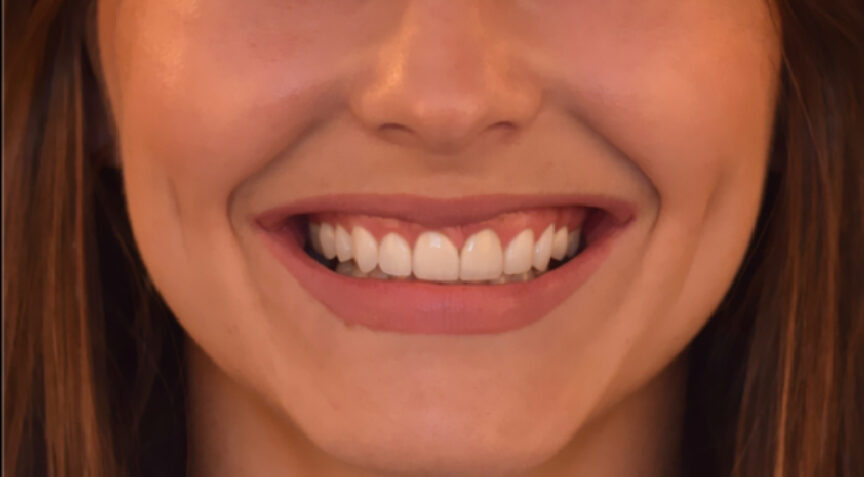 Advanced Dentistry - After