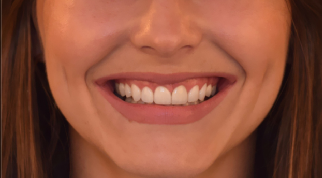 Advanced Dentistry - After