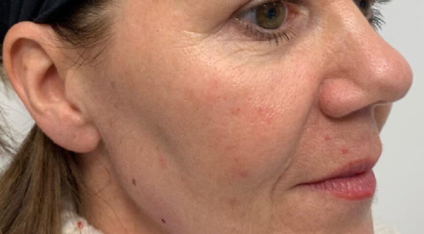 Advanced Dentistry - After