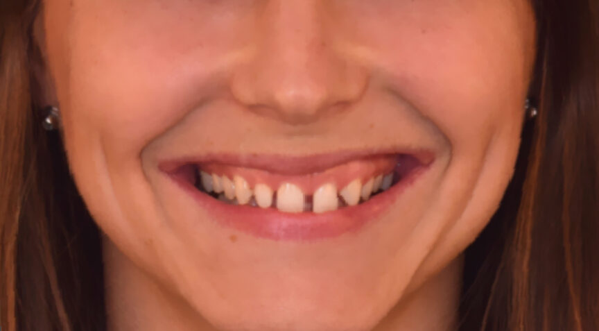 Advanced Dentistry - Before