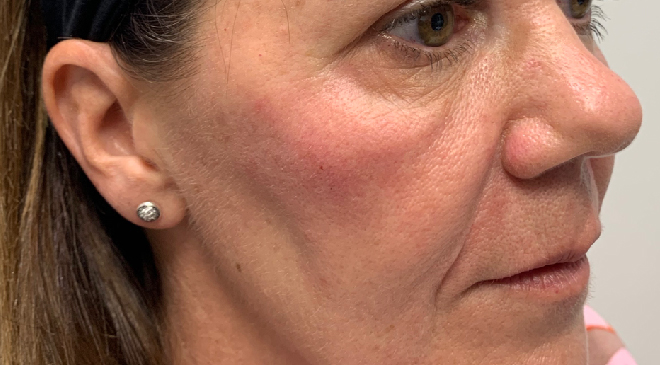 Advanced Dentistry - Before