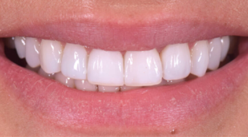 Advanced Dentistry - After