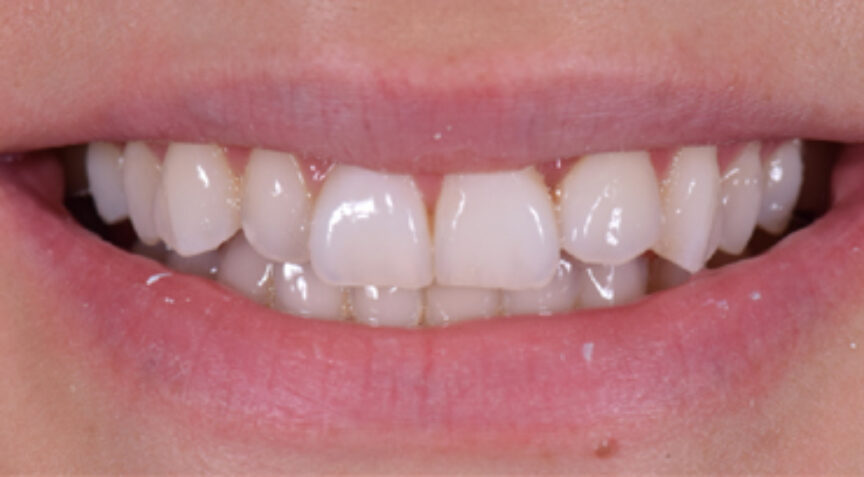 Advanced Dentistry - Before
