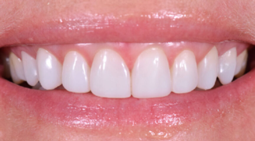 Advanced Dentistry - After