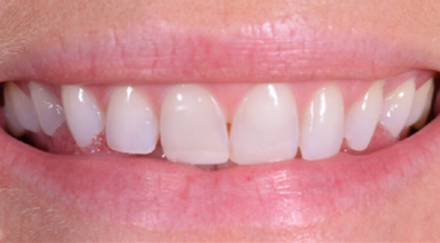 Advanced Dentistry - Before