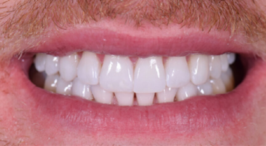 Advanced Dentistry - After