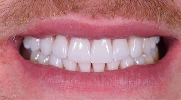 Advanced Dentistry - After