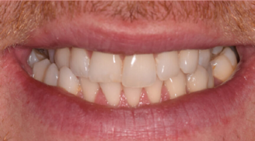 Advanced Dentistry - Before