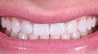 Advanced Dentistry - After