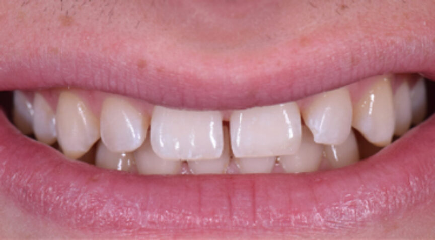 Advanced Dentistry - Before