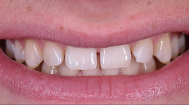 Advanced Dentistry - Before