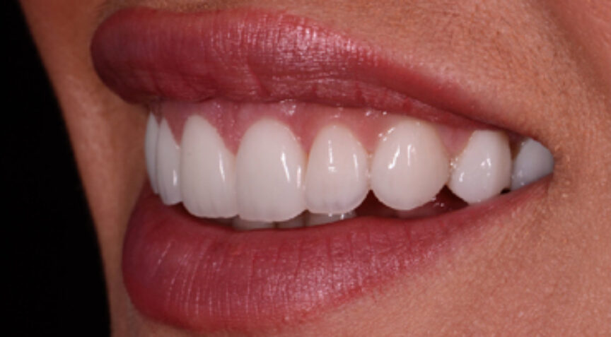 Advanced Dentistry - After