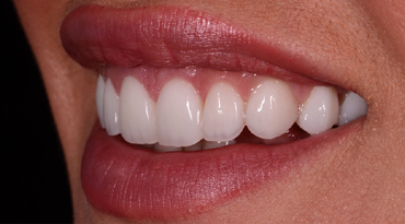 Advanced Dentistry - After
