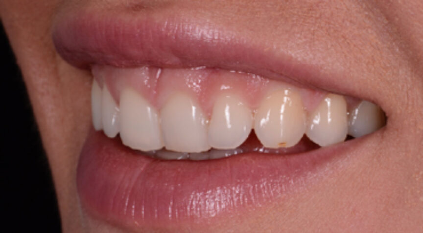 Advanced Dentistry - Before