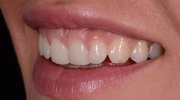 Advanced Dentistry - Before