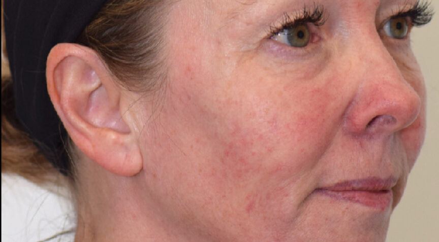 Advanced Dentistry - After