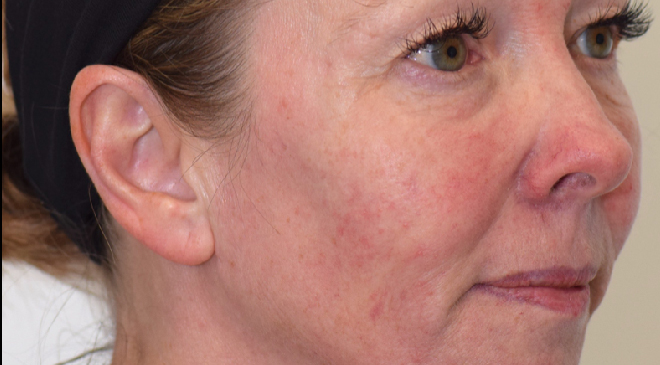 Advanced Dentistry - After