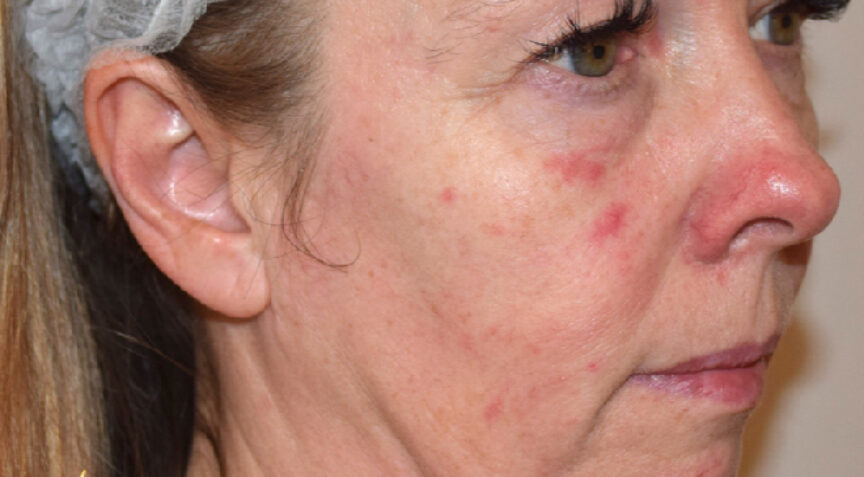 Advanced Dentistry - Before