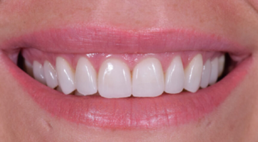 Advanced Dentistry - After