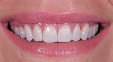 Advanced Dentistry - After