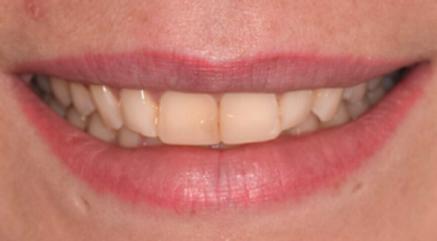 Advanced Dentistry - Before