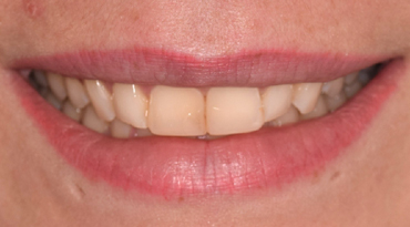 Advanced Dentistry - Before