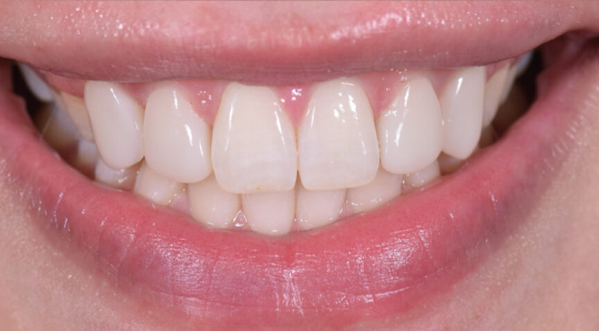 Advanced Dentistry - After