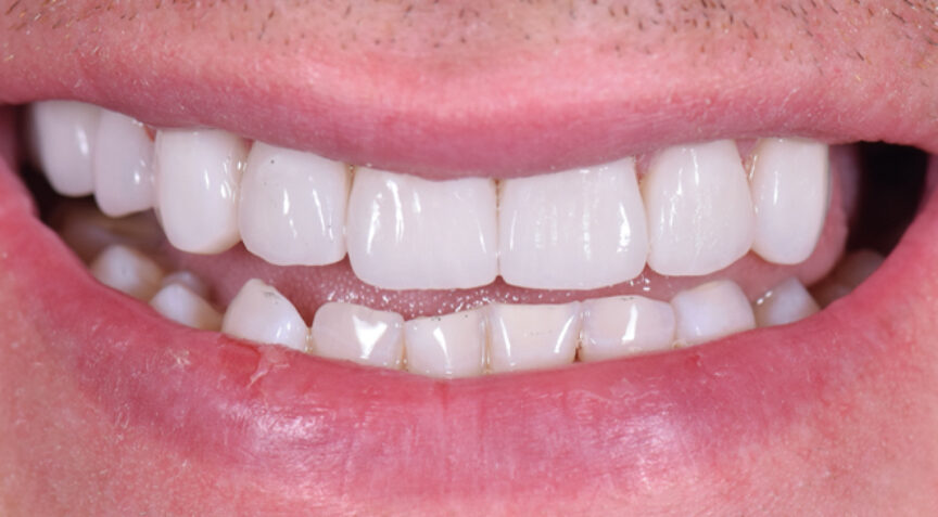 Advanced Dentistry - After