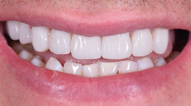 Advanced Dentistry - After