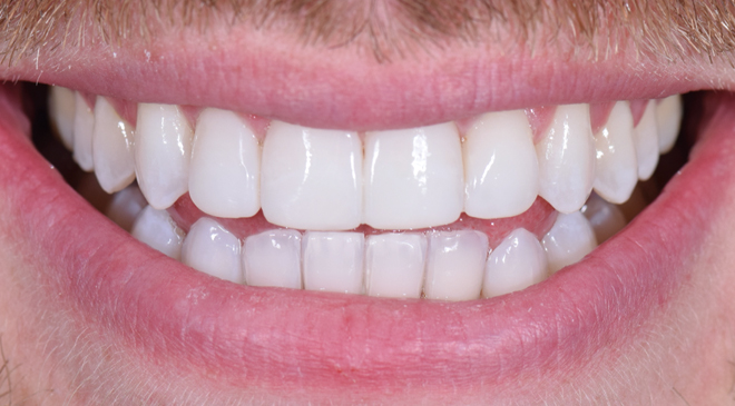 Advanced Dentistry - After