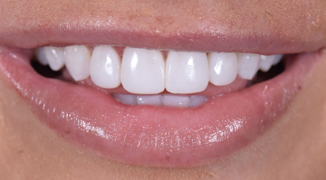 Advanced Dentistry - After