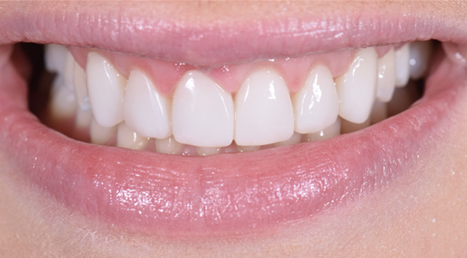 Advanced Dentistry - After