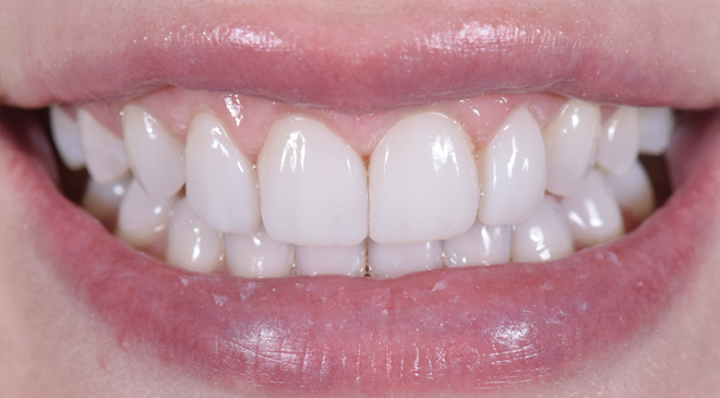 Advanced Dentistry - After