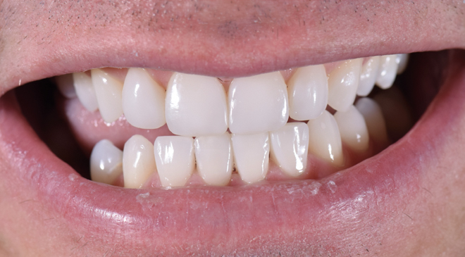 Advanced Dentistry - After