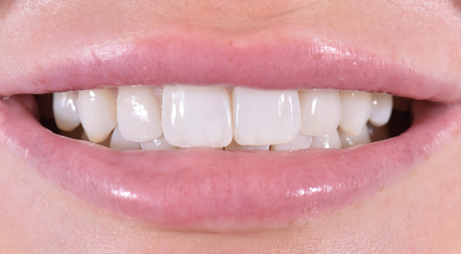 Advanced Dentistry - After