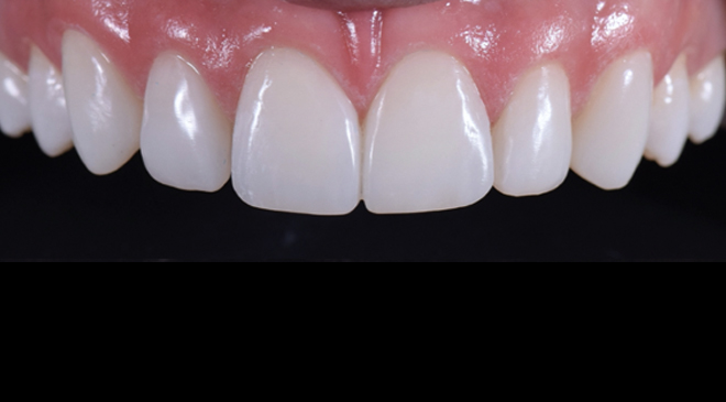 Advanced Dentistry - After