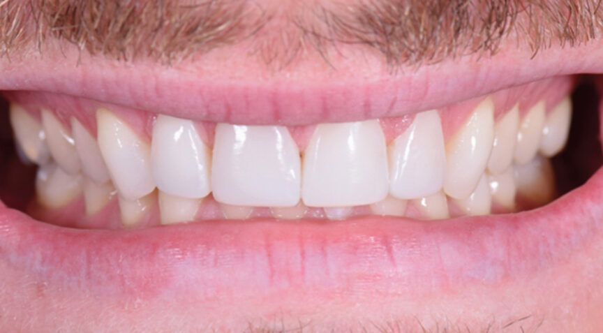 Advanced Dentistry - After