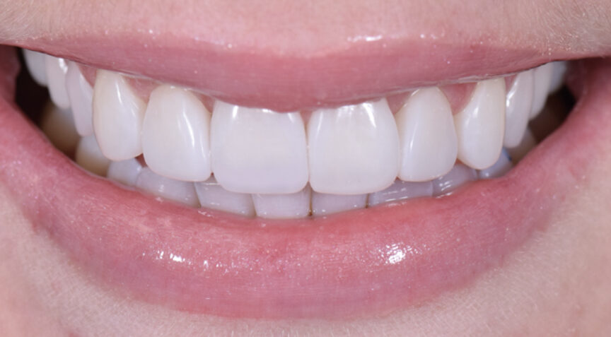 Advanced Dentistry - After