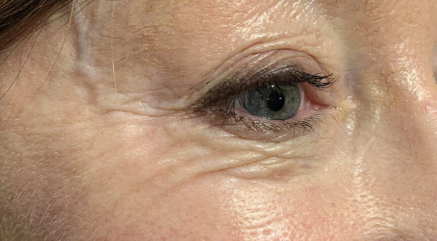 Advanced Dentistry - After