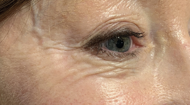 Advanced Dentistry - After