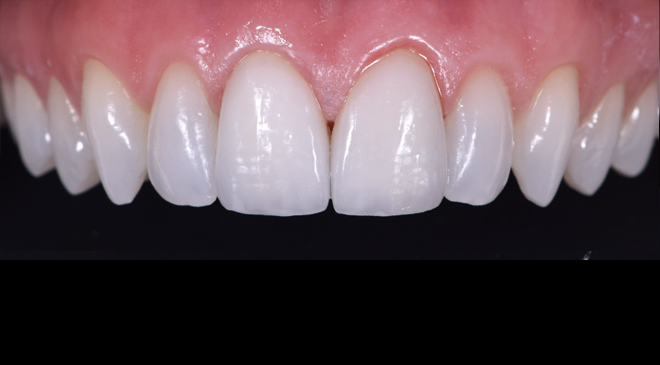 Advanced Dentistry - After