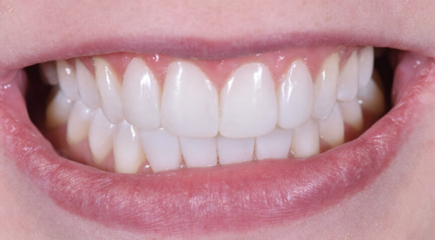 Advanced Dentistry - After