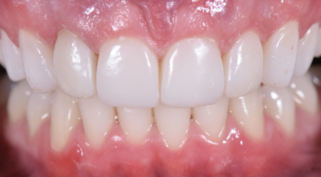 Advanced Dentistry - After