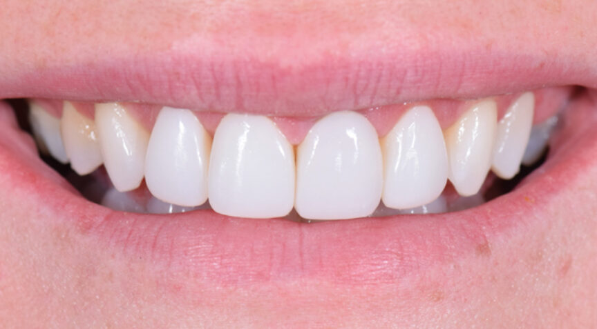 Advanced Dentistry - After