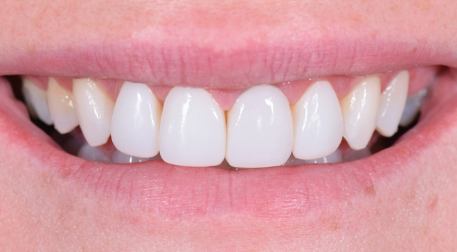 Advanced Dentistry - After