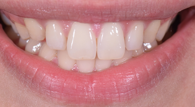 Before - Advanced Dentistry Dental Advanced Dentistry - Before