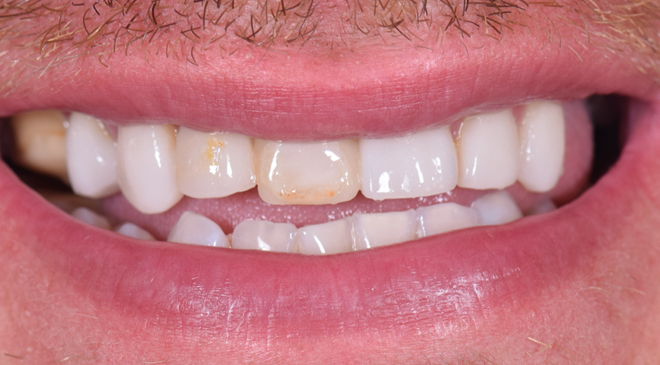 Advanced Dentistry - Before