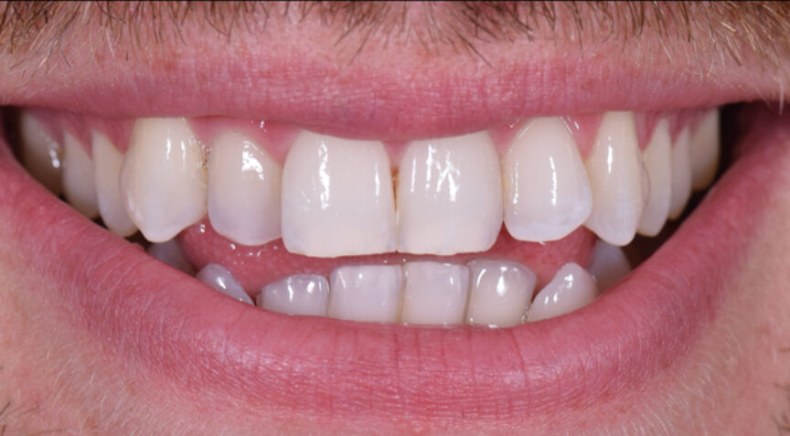Before - Advanced Dentistry Dental Advanced Dentistry - Before