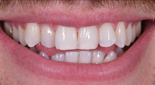 Advanced Dentistry - Before