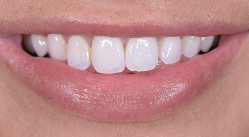 Before - Advanced Dentistry Dental Advanced Dentistry - Before